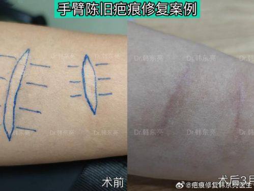 武汉大麦植发医院(原科发源)详细的预约挂号方式及流程