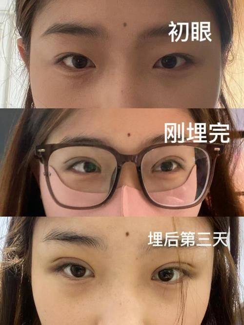 南宁密斯整形医疗美容医院是正规医院吗？