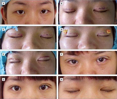 宣城泾县医院整形科医生团队实力强大及骨干医生简介