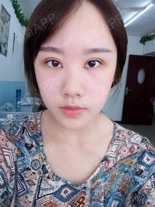 宣城泾县医院整形科是正规医院吗？