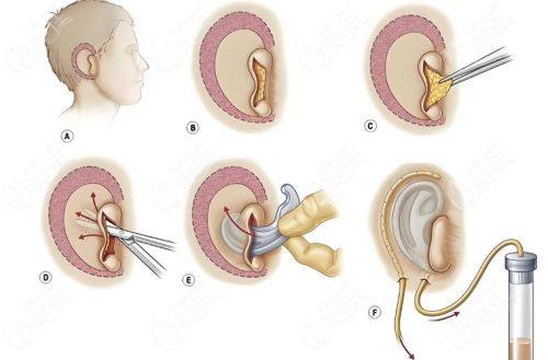 宣城泾县医院整形科地址电话营业时间