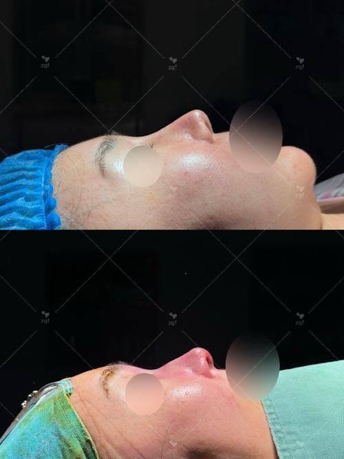 南宁密斯整形医疗美容医院收费价格表/收费标准