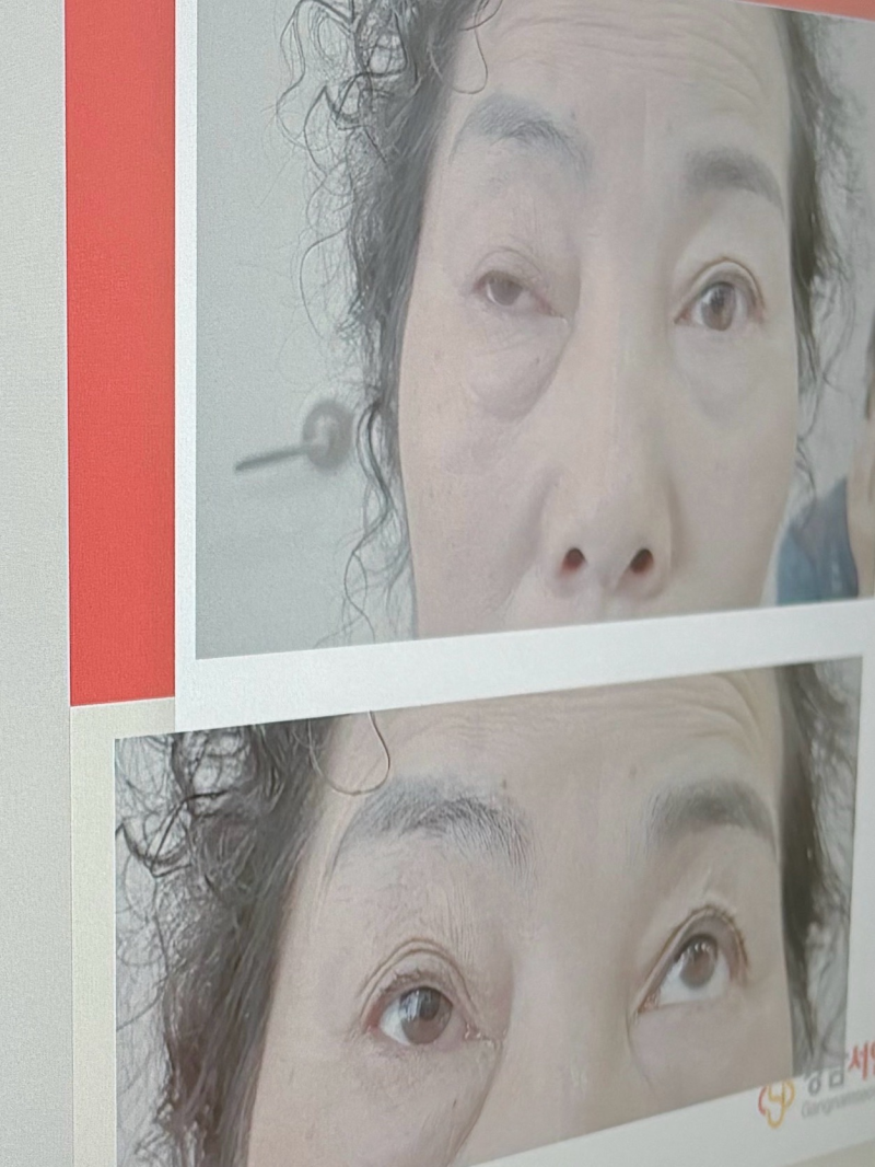 遵义青睐整形美容医院真人口碑评价怎么样？