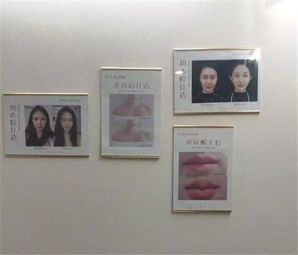 德州凯琳医疗美容门诊部林琦东是普通医生还是有实力？从资历、案例、评价看其水平 
