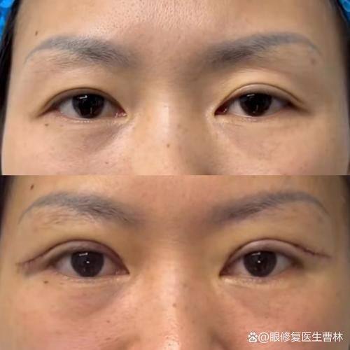 擅长项目