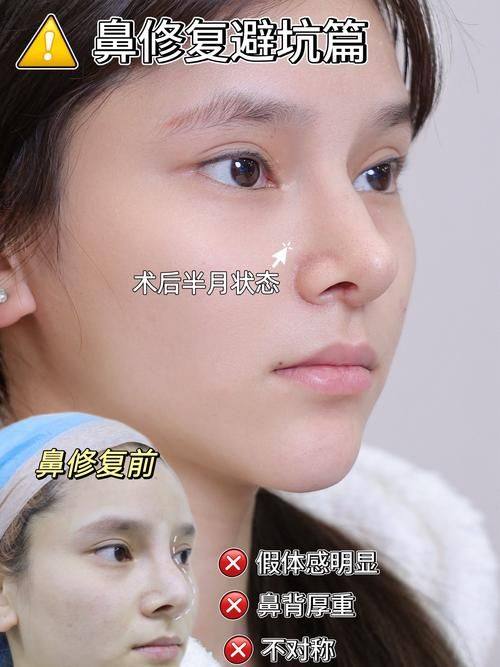 口碑评价及真人实例
