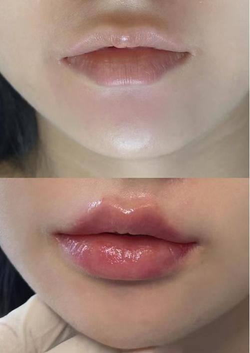 江油臻颜医疗美容诊所是正规医院吗?