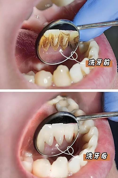 浙江湖州爱齿口腔诊所真人口碑评价怎么样？