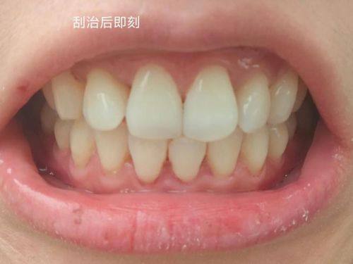 钟李燕医生预约挂号