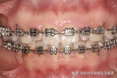 钟李燕医生技术优势