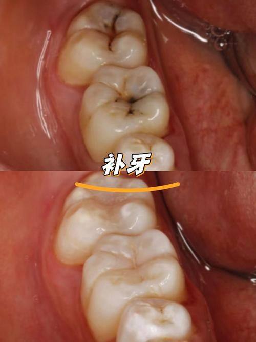 黄玉坤医生口碑评价及真人实例