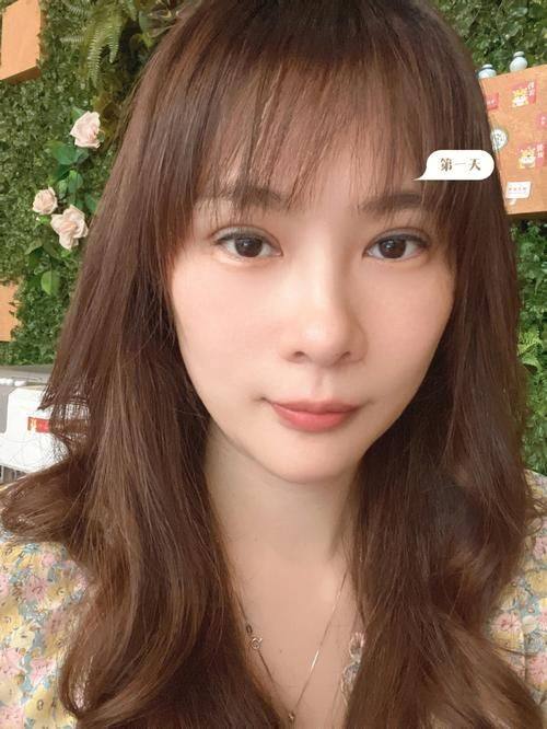 江油臻颜医疗美容诊所真人口碑评价怎么样?