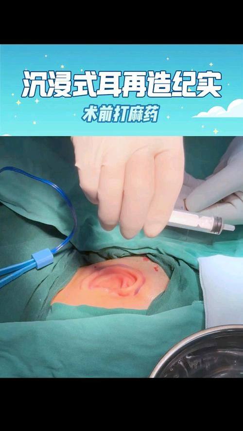 武汉至美整形医疗美容门诊部真人口碑评价怎么样？