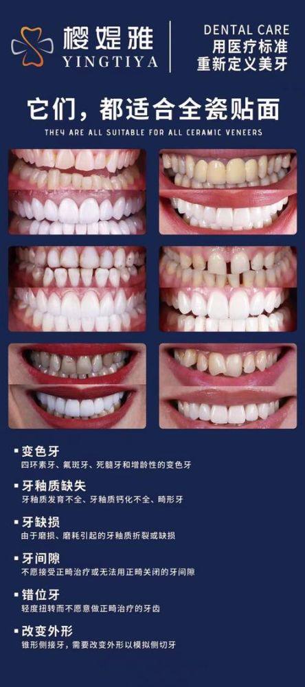连云港江南口腔门诊收费价格表/收费标准