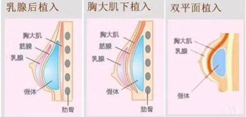 哈尔滨慧丽伊美整形医院详细的预约挂号方式及流程