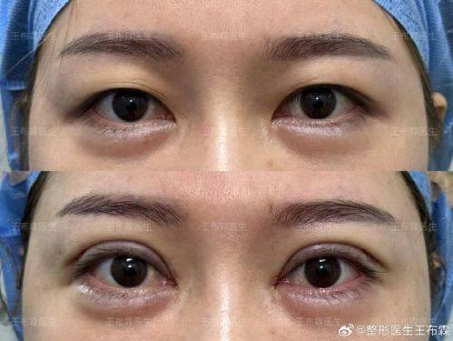 湘潭华美医疗美容门诊部真人口碑评价怎么样？