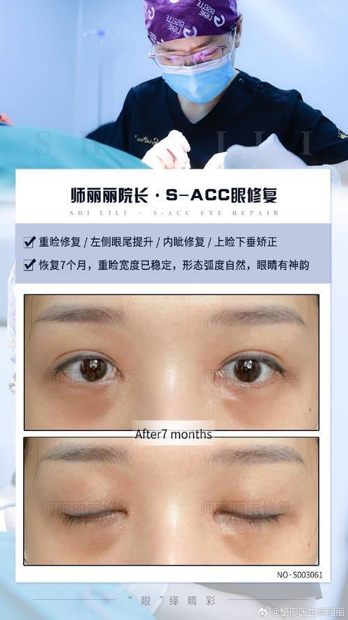 石家庄冀美整形美容医院特色项目及技术优势