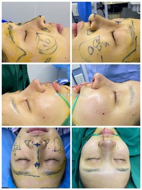 深圳美客华美医疗美容门诊部详细的预约挂号方式及流程