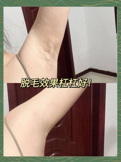 深圳美客华美医疗美容门诊部是正规医院吗？