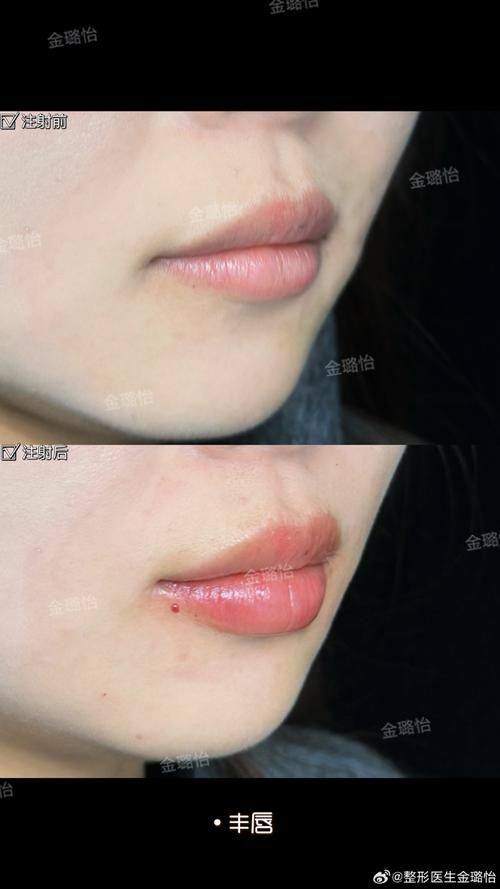 哈尔滨慧丽伊美整形医院是正规医院吗？