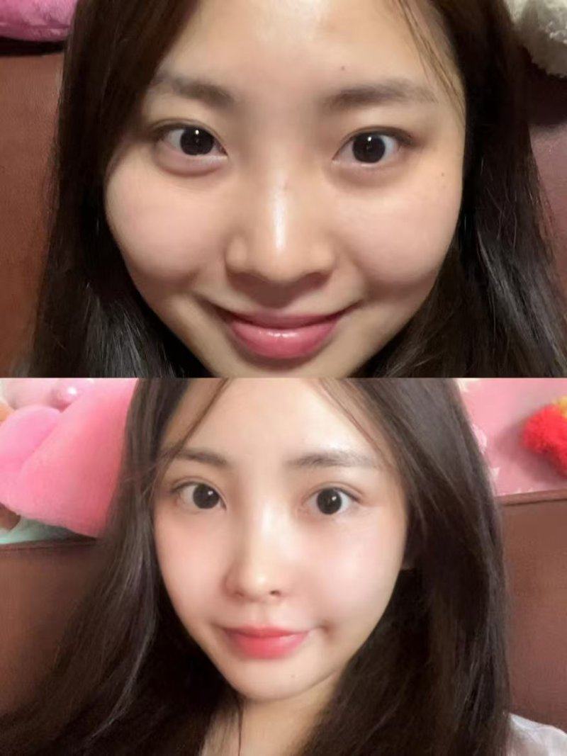 石家庄冀美整形美容医院是正规医院吗?
