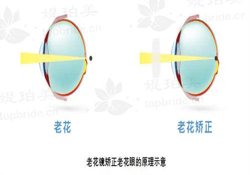 佳木斯爱视眼科医院医师团队经验丰实力强