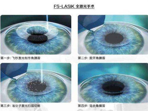 辽宁省金秋医院眼科详细的预约挂号方式及流程