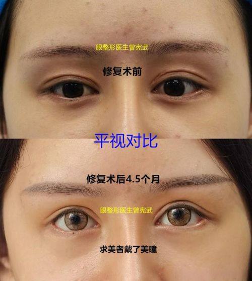 北京比华利医疗美容整形诊所收费价格表/收费标准