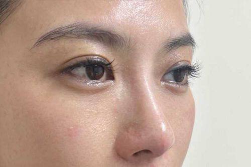 台州新(金)凤凰整形美容医院收费价格表/收费标准