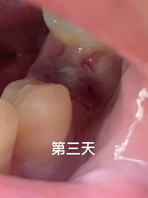 柳州鸿泰口腔收费价格表/收费标准