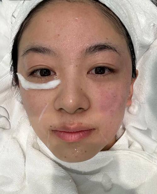 深圳留一美医疗美容诊所是正规医院吗？