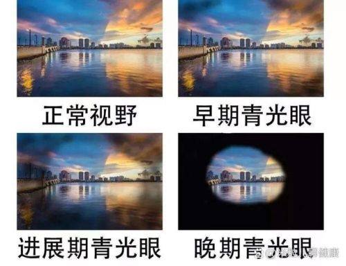 陈镇燕擅长的眼科项目
