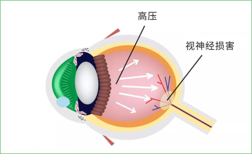 信阳市中 心医院眼科口碑评价