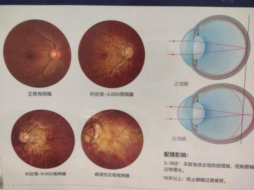 信阳市中 心医院眼科设备