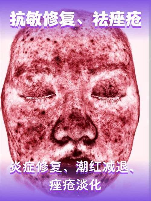 北京比华利医疗美容整形诊所详细的预约挂号方式及流程