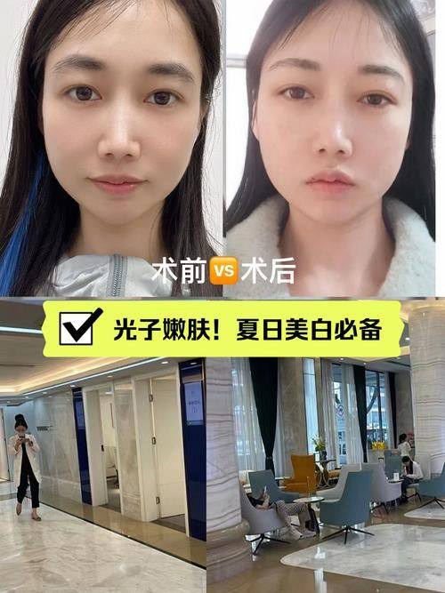 魏小红医生技术优势