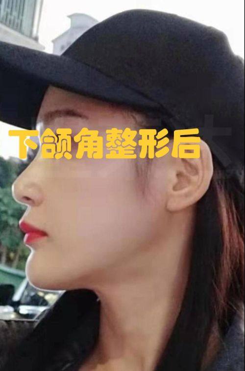 鲁传龙医生技术实力