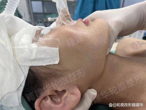 沈阳创美荟医疗美容擅长项目