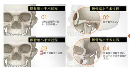 朱启刚医生擅长项目