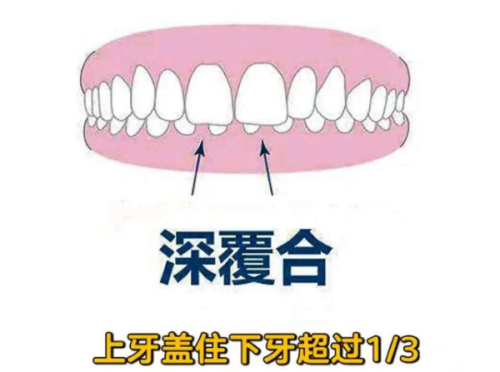 李蔚医生技术优势