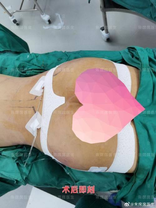 上海辰新医院医学美容科真人口碑评价怎么样？
