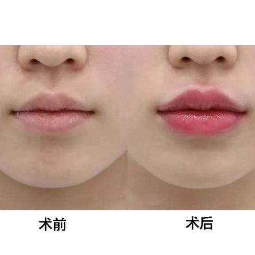 绍兴新昌艺素美整形医疗美容诊所真人口碑评价怎么样？