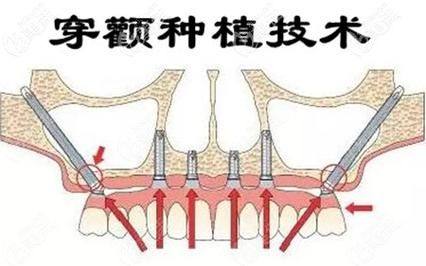 杨万柳医生坐诊医院
