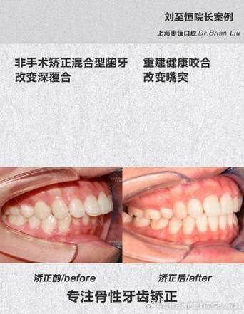 南京京冠口腔门诊部治疗反馈与口碑评价。