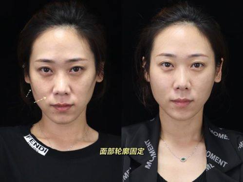 肖玮医生技术实力