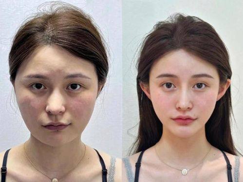 整形医院口碑评价