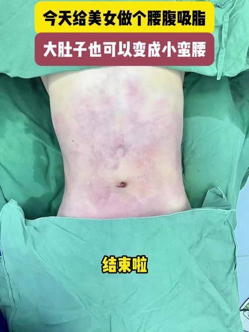 沈阳创美荟整形医院真人口碑评价怎么样？