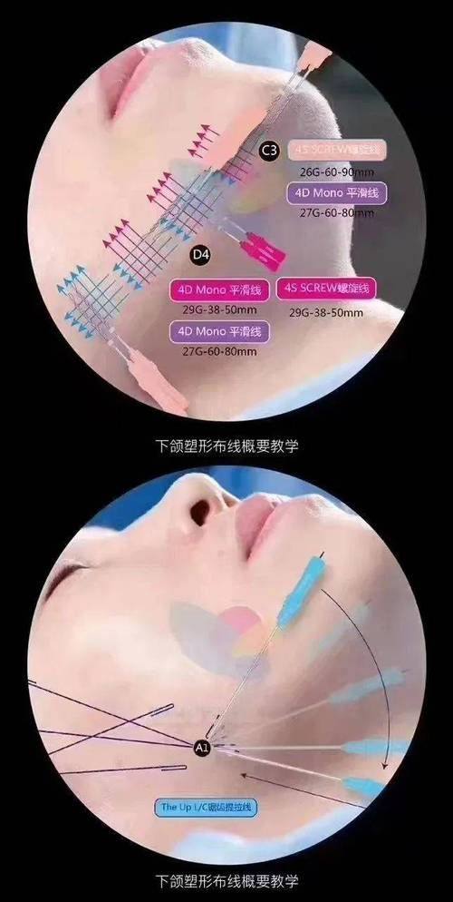 沈阳创美荟整形医院详细的预约挂号方式及流程