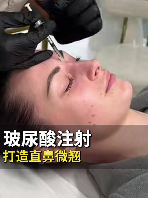 吴钟卓医生口碑评价及真人实例