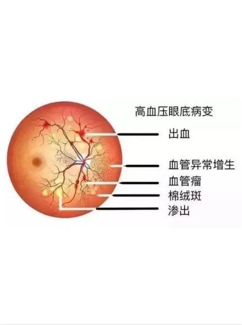 晋中爱尔眼科医院真人口碑评价怎么样?